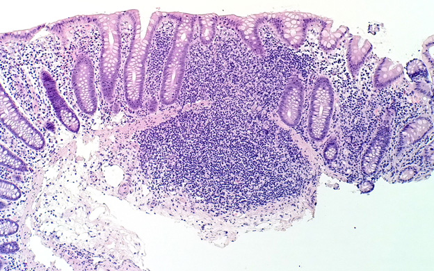 Lumia-Microscope-shot