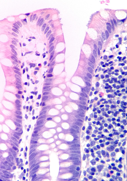 Lumia-Microscope-shot1