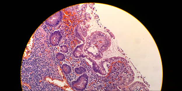 Lumia-Microscope-shot2